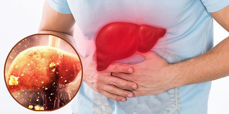 Quá trình phát triển của xơ gan qua từng giai đoạn