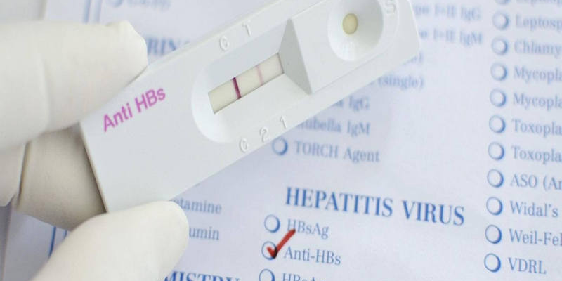 Chỉ số Anti HBs phản ánh mức độ bảo vệ cơ thể trước sự tấn công của virus viêm gan B