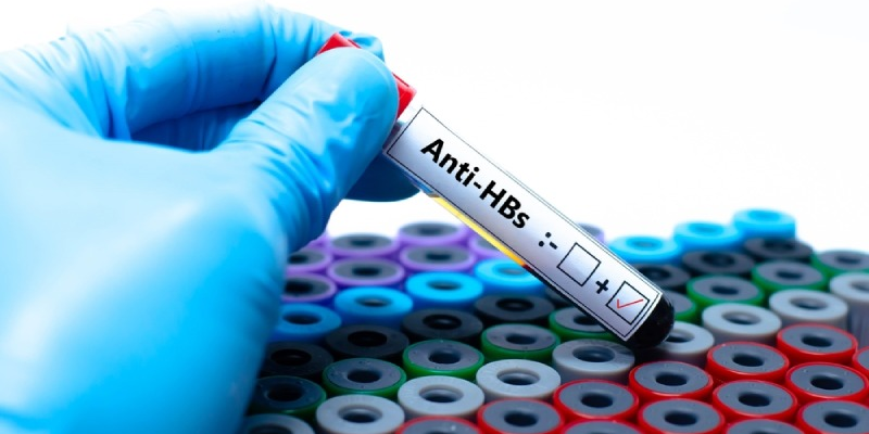 Kết quả Anti-HBs có thể bị ảnh hưởng bởi tuổi tác, bệnh lý nền, thời điểm và phương pháp xét nghiệm.
