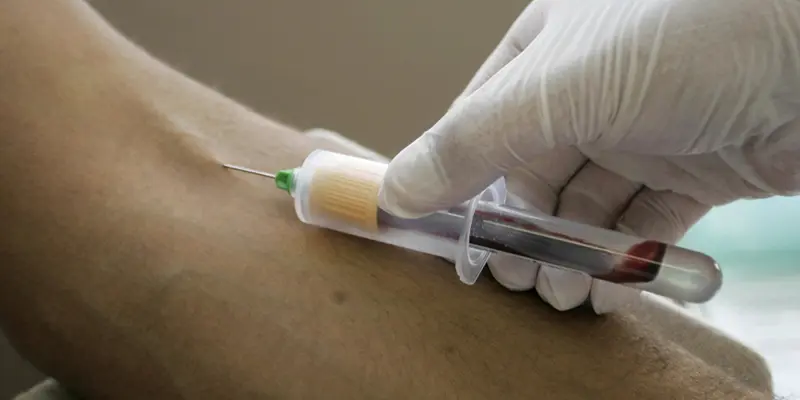 Xét nghiệm ALT và AST sẽ cho biết nồng độ men gan trong máu cao hay thấp.