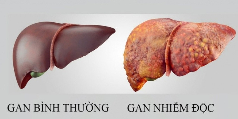 Trả lời cho câu hỏi nhiễm độc gan có nguy hiểm không