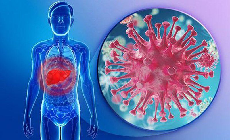 Bệnh viêm gan virus A