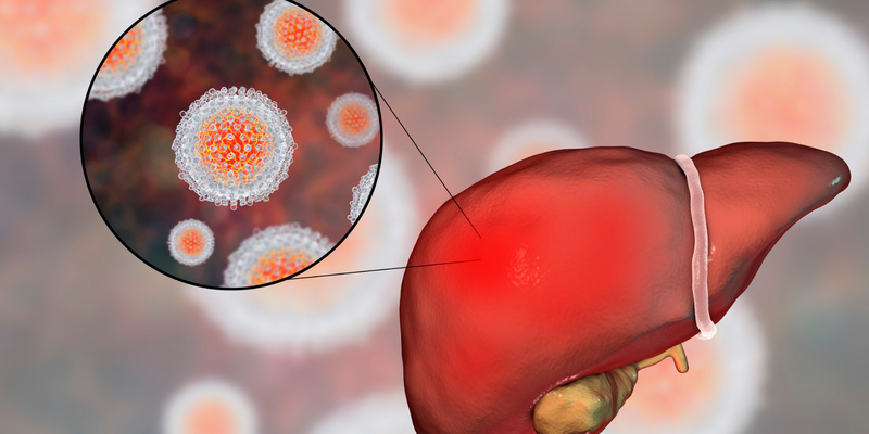 Nhiều người khi phát hiện nhiễm viêm gan B thường băn khoăn viêm gan B có hết không