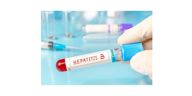Viêm gan B là một bệnh lý truyền nhiễm do virus viêm gan B (HBV) gây ra