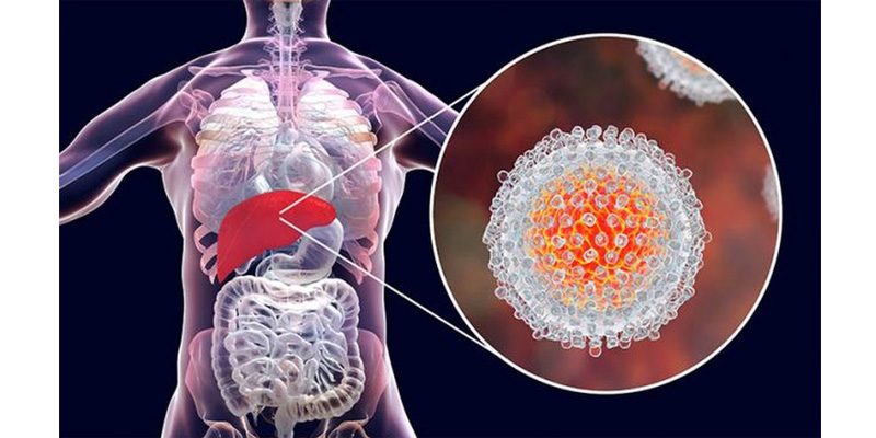 Câu trả lời cho câu hỏi viêm gan C có tự khỏi không