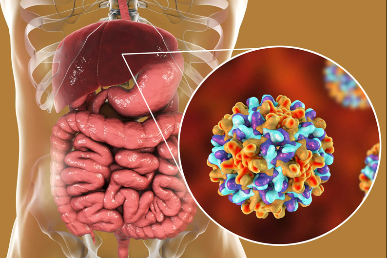 Bệnh viêm gan virus C