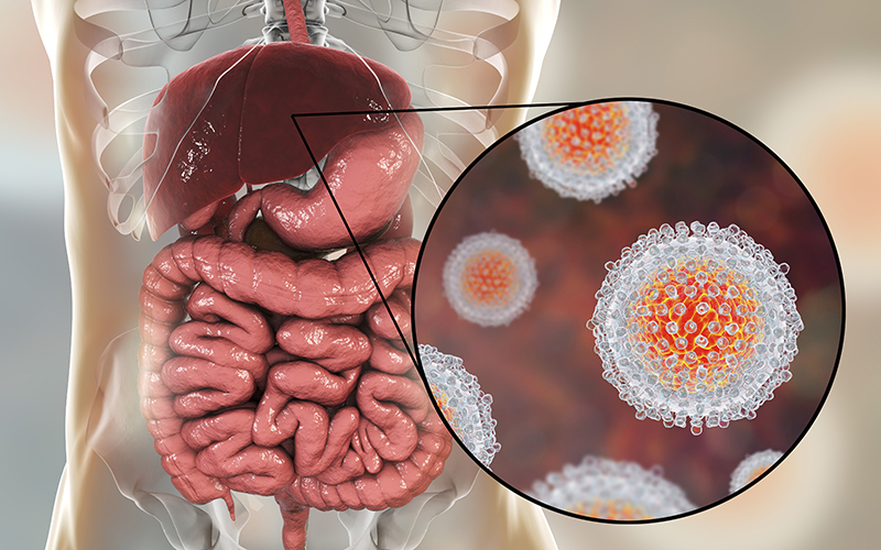 Bệnh viêm gan virus E