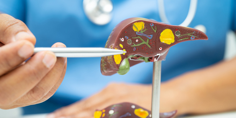 Bệnh nhân xơ gan F3 sống được bao lâu?