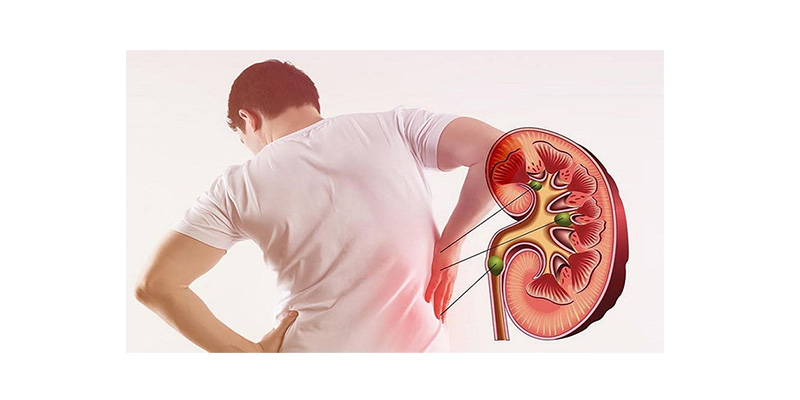 Biến chứng viêm cầu thận thường gặp ở người bị nhiễm viêm gan B và C mạn tính 