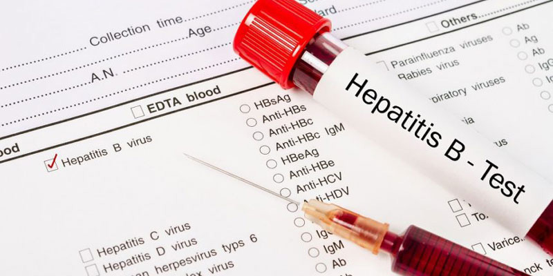 Các chỉ số xét nghiệm viêm gan B là kết quả rõ ràng tình trạng bệnh
