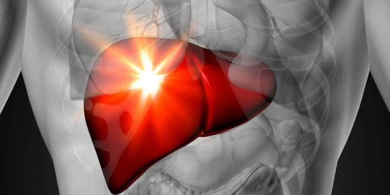 Suy gan là tình trạng chức năng gan bị suy giảm nghiêm trọng, khiến gan không thể thực hiện chức năng