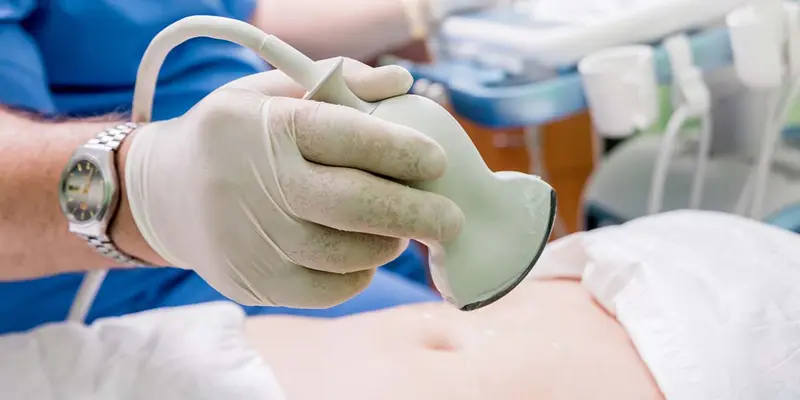 Sinh thiết gan là phương pháp chẩn đoán xơ gan ứ mật