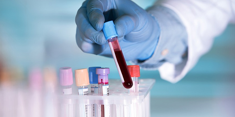 Chẩn đoán bệnh não gan bằng cách xét nghiệm máu