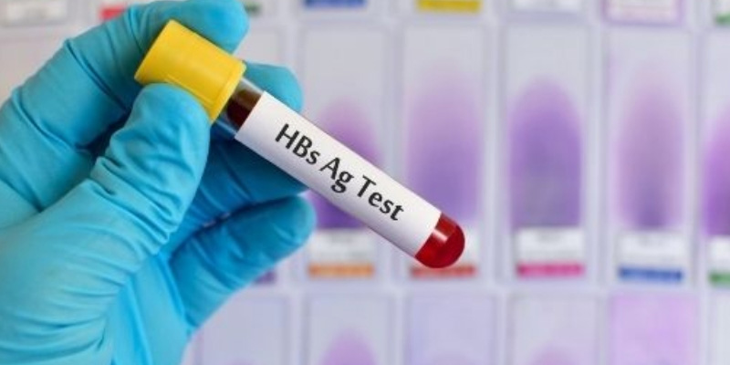 Chẩn đoán và xét nghiệm viêm gan B thể hoạt động