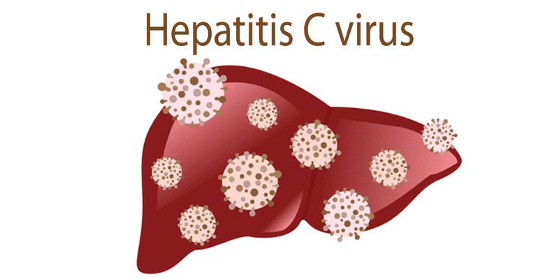 Viêm gan C cấp tính được gây ra do HCV gây ra đồng thời có thể dẫn đến viêm gan mạn tính