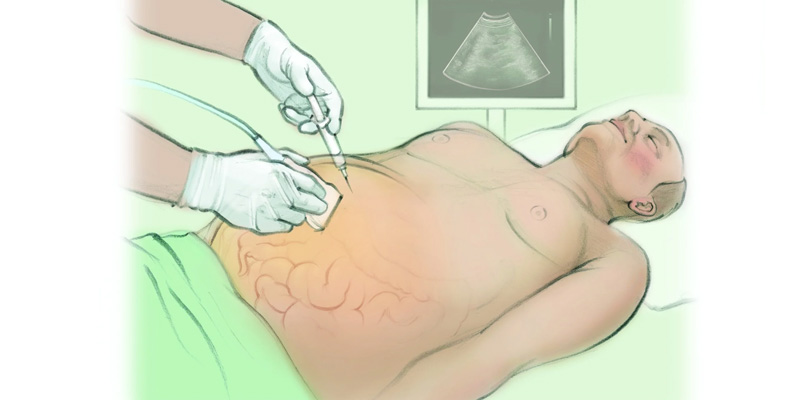 Bệnh nhân sẽ được hướng dẫn và cần hợp tác theo hướng dẫn của nhân viên y tế để tránh các tai biến không mong muốn.