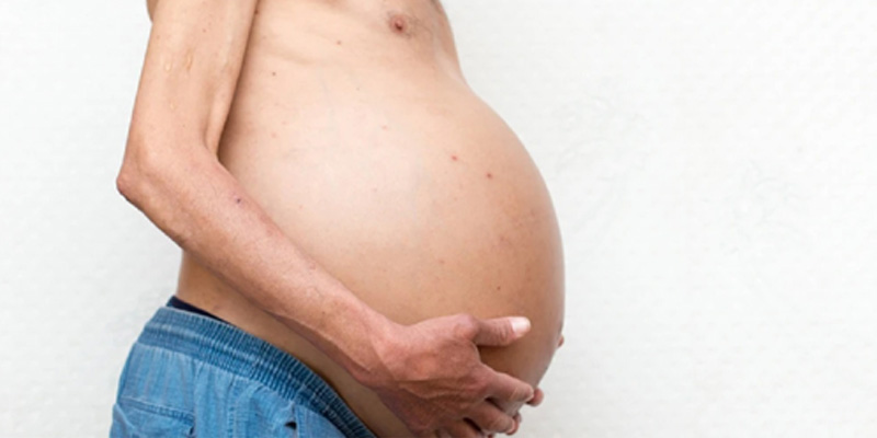 Xơ gan cổ trướng giai đoạn cuối