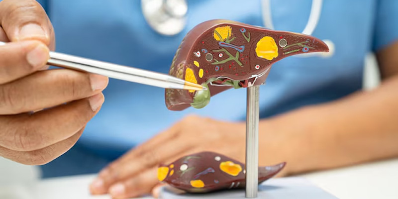 Người bệnh cần điều trị viêm gan D theo chỉ định của bác sĩ