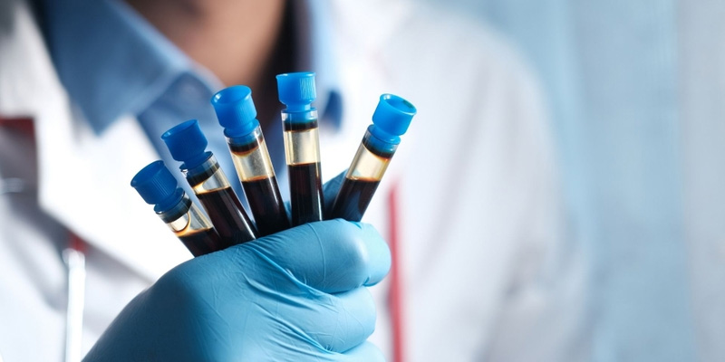 Xét nghiệm men gan là phương pháp giúp phát hiện bệnh sớm