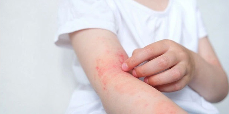 Ngứa da chính là một tín hiệu cảnh báo gan đang gặp vấn đề