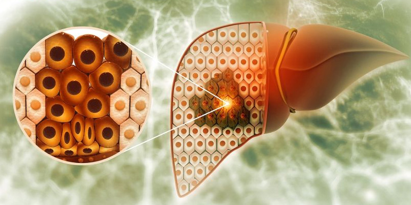 Viêm gan có thể do virus gây ra