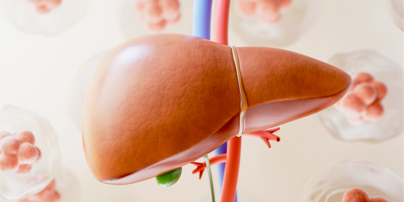 Gan nhiễm mỡ có thể gây ra ung thư