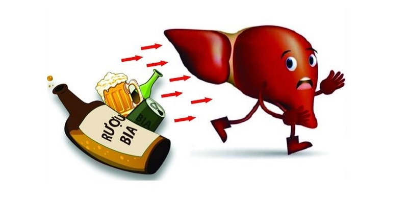 Rượu là nguyên nhân dẫn đến xơ gan và gan nhiễm mỡ