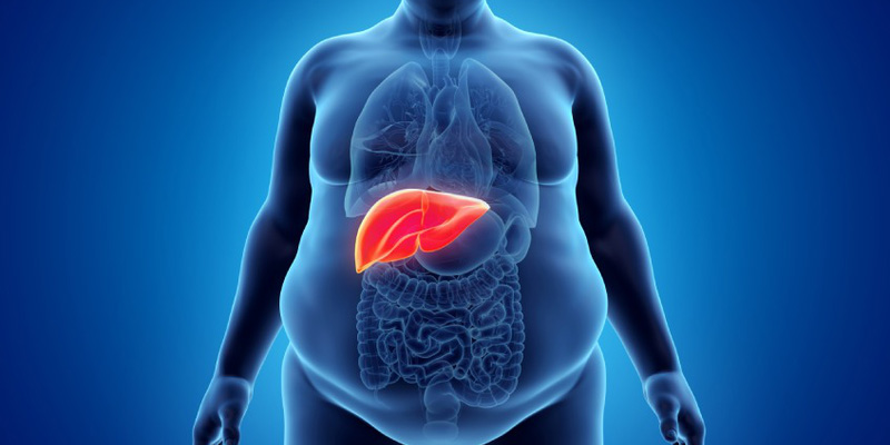 Bệnh nhân chủ yếu tình cờ phát hiện ra khi khám bệnh trên siêu âm gan.