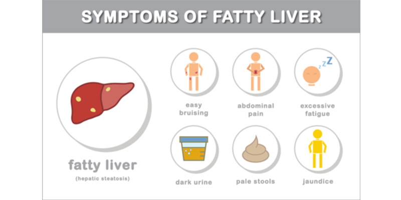 Các biểu hiện của gan nhiễm mỡ ở các giai đoạn sau