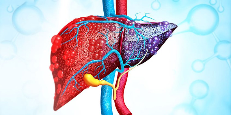 Gan nhiễm mỡ có thể khiến nhiều cơ quan bị ảnh hưởng