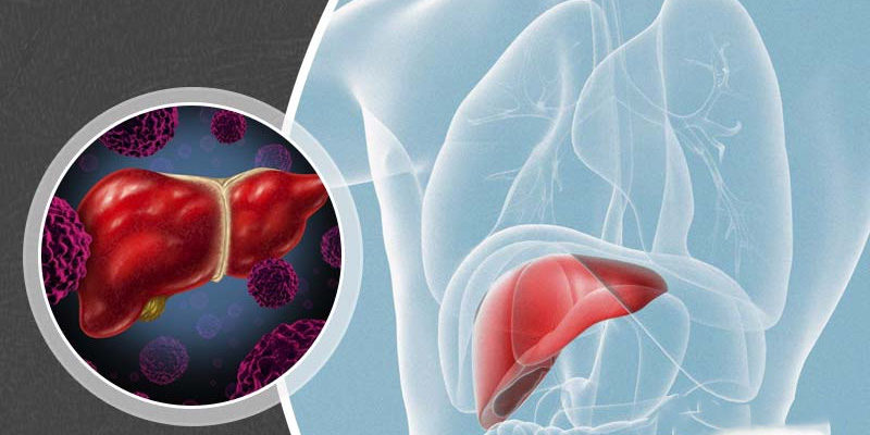 Bệnh có thể do nhiều nguyên nhân khác nhau.