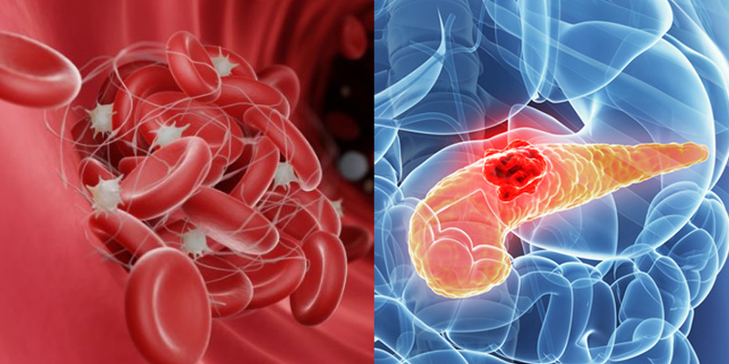 Sau sinh, mẹ cần được theo dõi huyết động