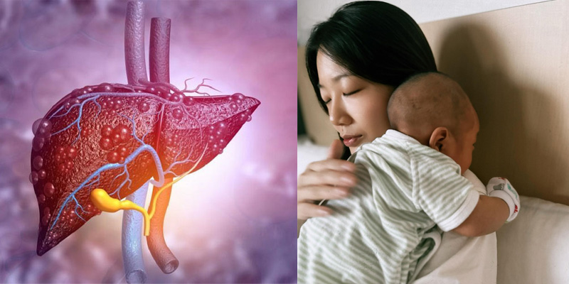 Sự tích tụ mỡ trong tế bào gan xảy ra sau khi sinh con là tình trạng gan nhiễm mỡ sau sinh