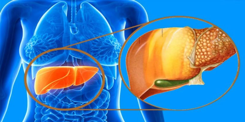 Gan nhiễm mỡ là nguyên nhân quan trọng gây ra tiểu đường