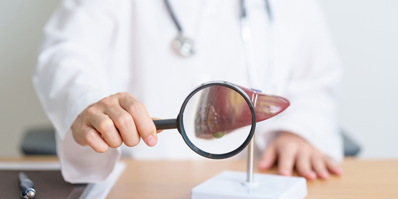 Xơ gan cổ trướng