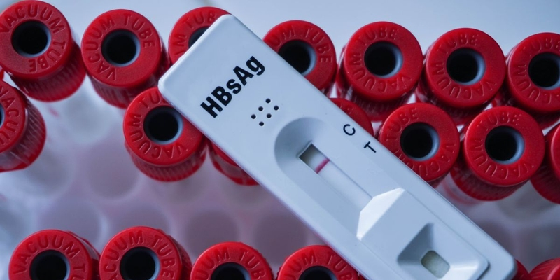 Bệnh nhân cần TD viêm gan sẽ được chỉ định thực hiện xét nghiệm cần thiết