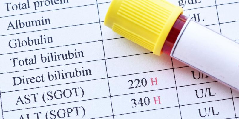 Kiểm tra chức năng gan (AST, ALT, bilirubin) phản ánh mức độ tổn thương tế bào gan và tình trạng ứ mật.