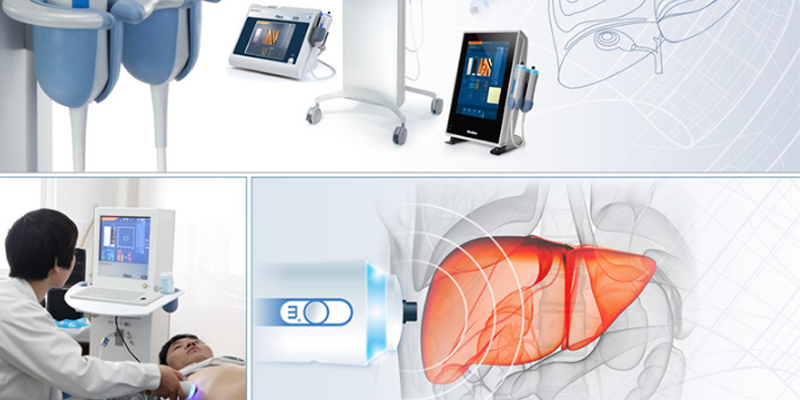 Siêu âm đàn hồi mô gan quan trọng ở bước phân tích số liệu để đưa ra kết quả chính xác