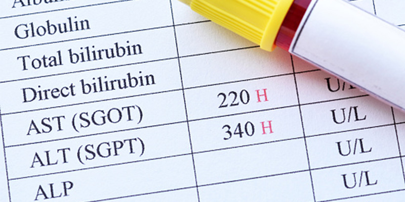 Men gan cao là tình trạng nồng độ các enzyme gan trong máu vượt quá mức bình thường