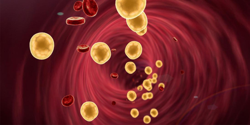 Mỡ máu cao, hay còn gọi là rối loạn chuyển hóa lipid máu