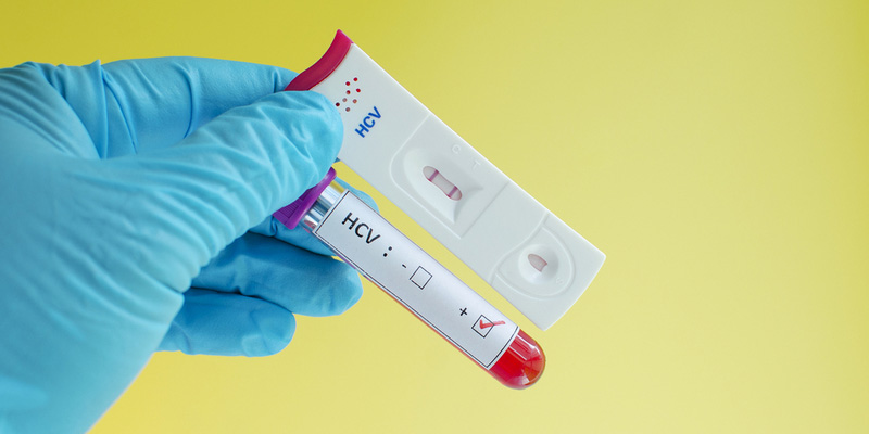 Nên xét nghiệm viêm gan C khi chuẩn bị có kế hoạch mang thai