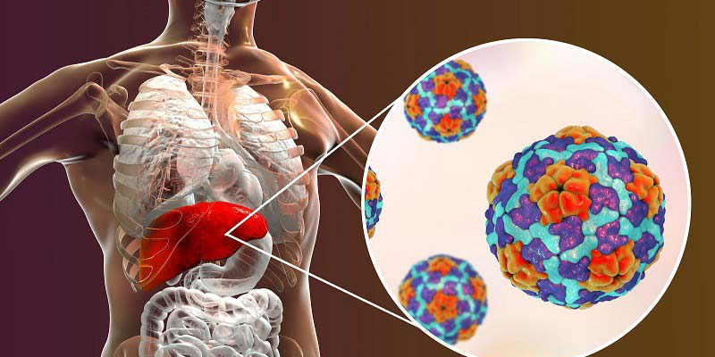 Nhiễm trùng do virus dễ dẫn tới các bệnh về gan