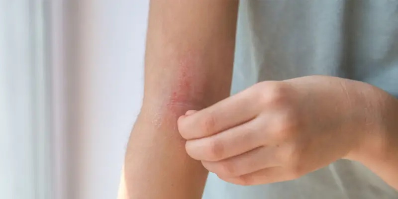 Nhận biết sớm các triệu chứng viem gan C để phòng ngừa bệnh 