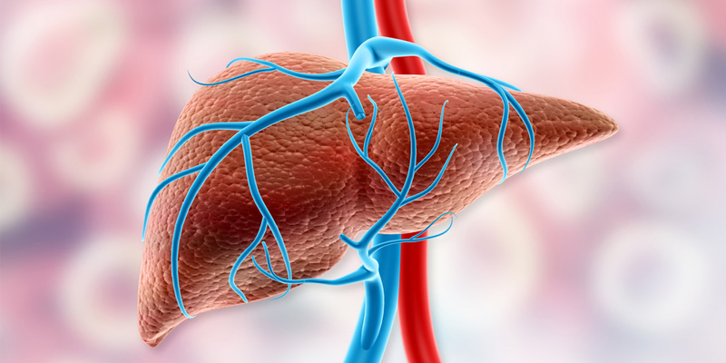 Tăng áp lực tĩnh mạch cửa là cơ chế gây phù ở người bệnh xơ gan