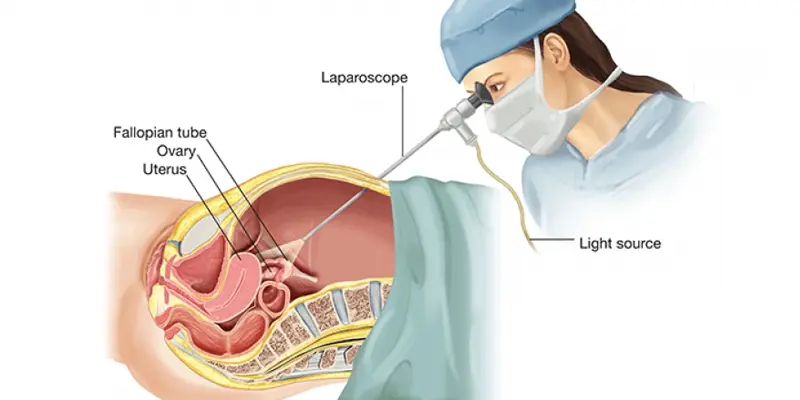 Siêu âm ổ bụng để kịp thời phát hiện ra tế bào ung thư gan