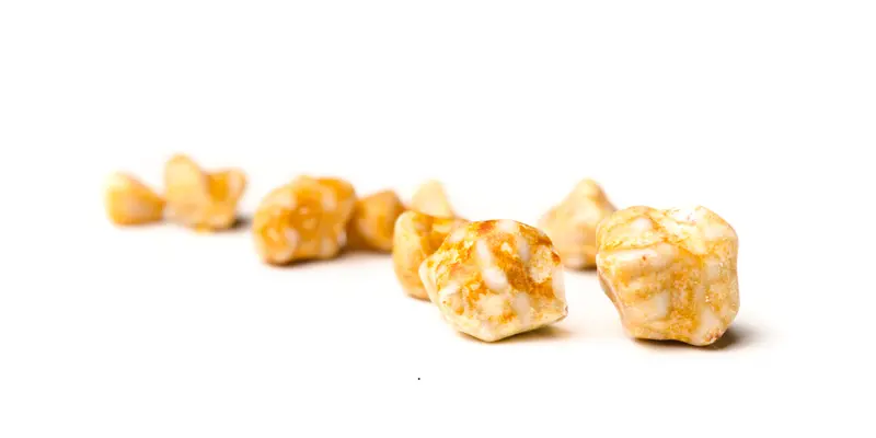 Sỏi mật có hình dạng và màu sắc đa dạng