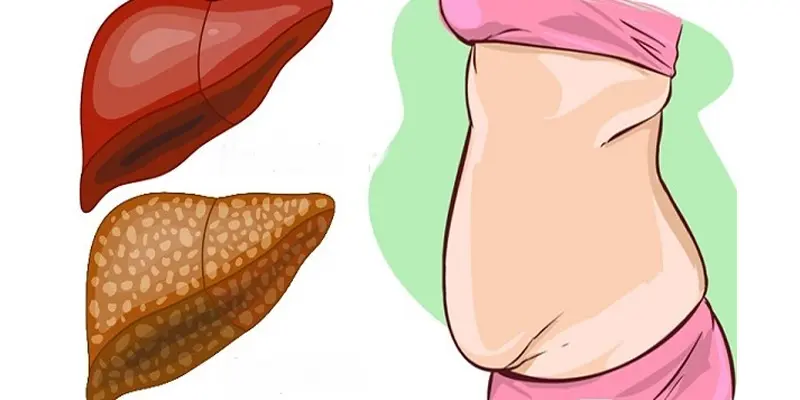 Bấm huyệt có hiệu quả cải thiện tình trạng gan nhiễm mỡ