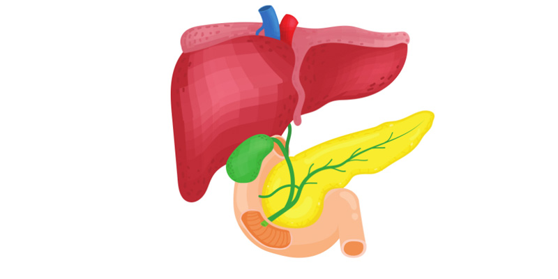 Tắc mật ngoài gan