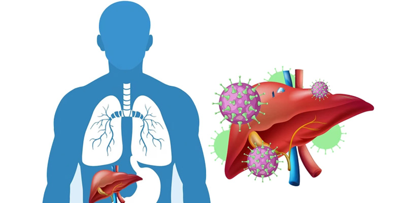 Người mắc viêm gan virus B hoặc C mạn tính nên tầm sóa ung thư gan sớm