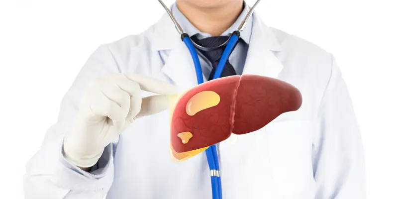 Đông y cho rằng bệnh gan nhiễm mỡ có nguyên nhân chủ yếu do cholesterol cao